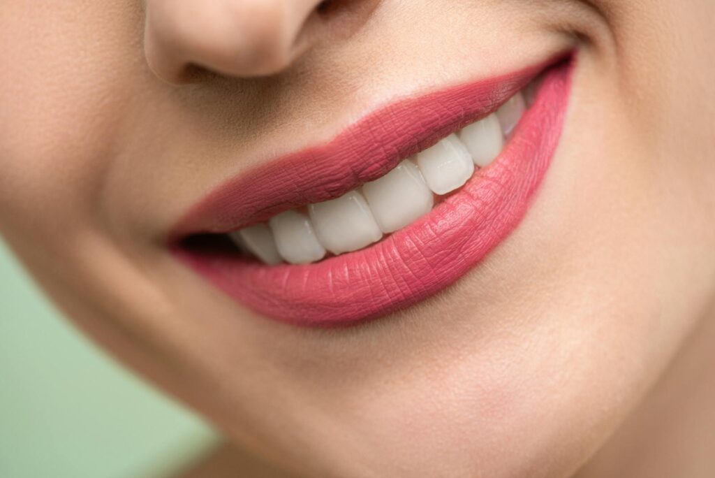 Close-up of bright white smile after porcelain veneer treatment in Jeddah, Saudi Arabia